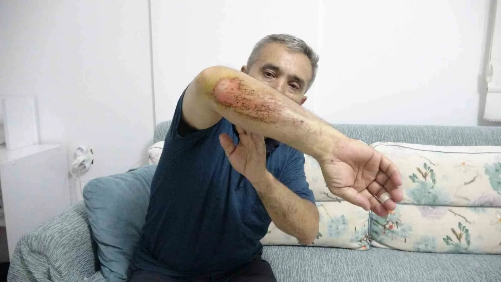 Otizmli oğluyla doğa gezisi sırasında sahipli köpeklerin saldırısına uğradı