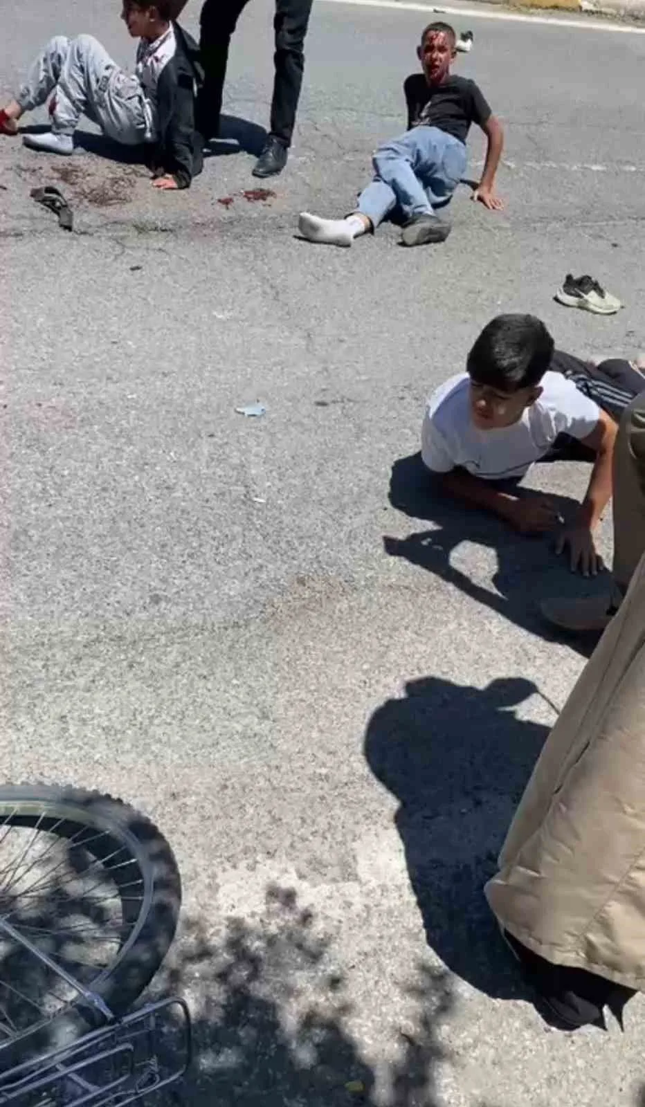 Patnos’ta otomobilin çarptığı 3 bisikletli çocuk yaralandı